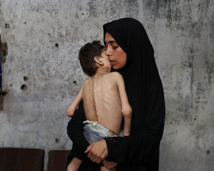 “Save us, we’re slowly starving to death” – Gaza faces worsening hunger after a week of devastating events