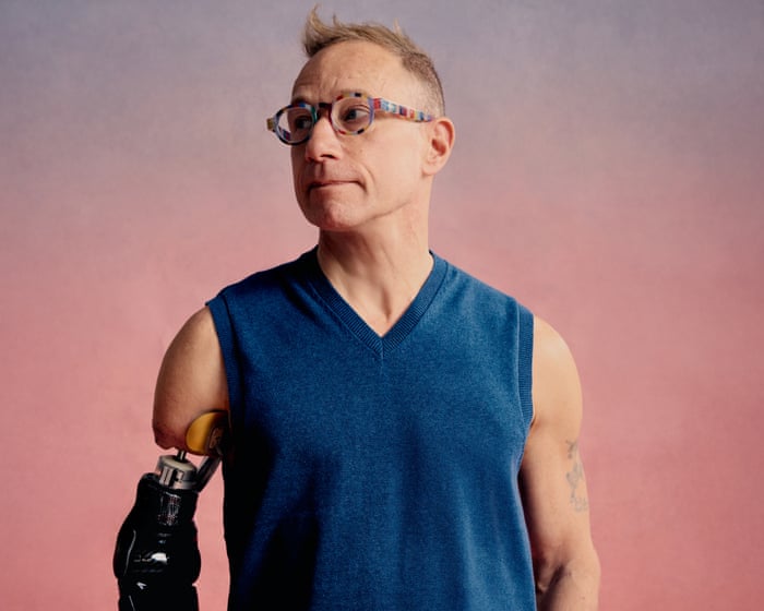 For years, he designed and built artificial limbs. Then a truck tore off his right arm. How did the expert cope when he suddenly became the patient?