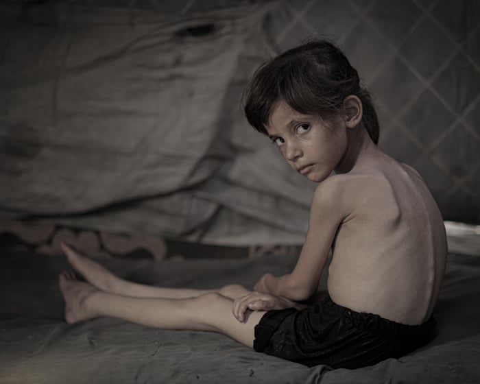 The math of hunger: how Israel triggered famine in Gaza