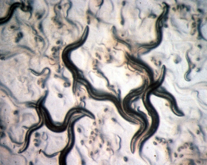 Por supuesto que no. No hay necesidad de una "limpieza de parásitos".