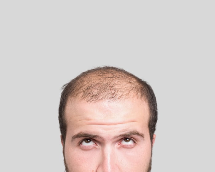 20 fascinating facts about hair: why baldness is very masculine – and pubic hair could be a 'cheating detector'